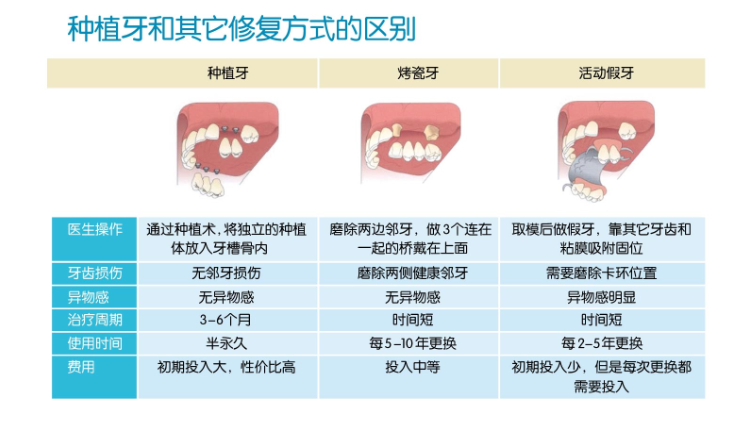  牙齒加工廠