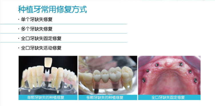  牙齒加工廠